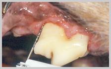 Up to 50% attachment loss with dormant disease