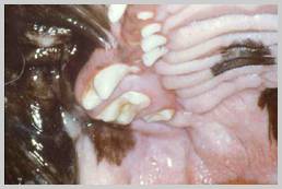 Crowded teeth