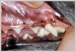 Normal healthy gingiva with a deep cleft over the mesiobuccal root of upper fourth pre-molar