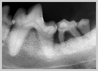 Radiograph showing up to 50% bone loss