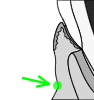 Mucogingival Junction