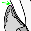 Gingival sulcus