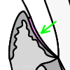 Junctional epithelium