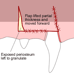Sliding Flap 4