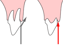 Odontoplasty 1