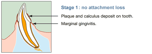No attachment loss in tooth