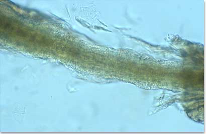 A plucked hair from a cat with M. canis dermatophytosis