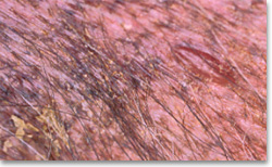 Vesicle with haemorhagic  contents on the skin of a dog with a drug reaction