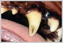 Oblique fracture of buccal 104 crown with pulp exposure