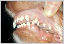 Severe class 2 malocclusion