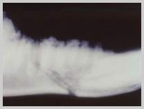 "Favourable" fracture of mid body of mandible with fracture running from caudo-dorsal to rostro-ventral