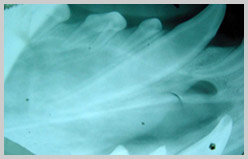 Fractured upper canine of a young dog with immature, thin walls and an open apex