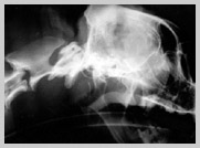 Radiograph showing joint space using open mouth technique variation