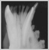 Lower canine post-operative root canal treatment