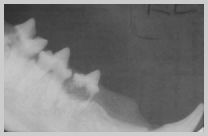 Feline odontoclastic resorptive lesions