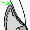 Gingival sulcus