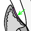 Junctional epithelium